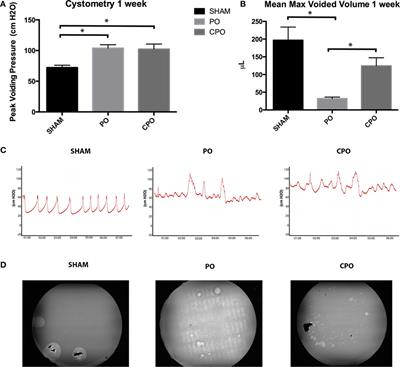 Testosterone Modifies Alterations to Detrusor Muscle after Partial Bladder Outlet Obstruction in Juvenile Mice